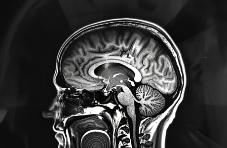 foramen