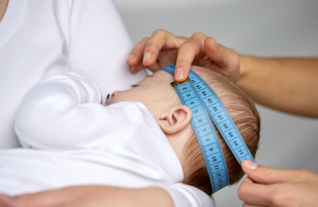 macrocephaly