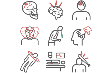 tbi